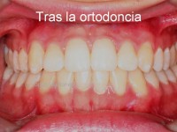 090-fianl ortodoncia con aguas